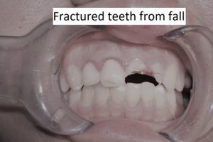 Oral surgery illustration